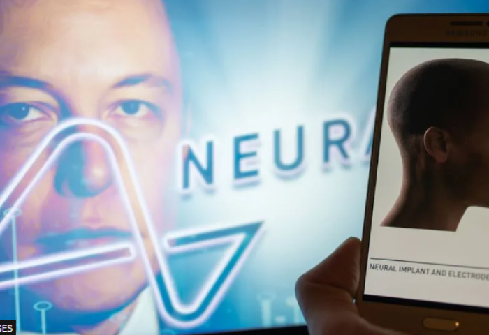 Элон Маск анхны Neuralink утасгүй тархины чипээ хүнд суулгаснаа зарлалаа