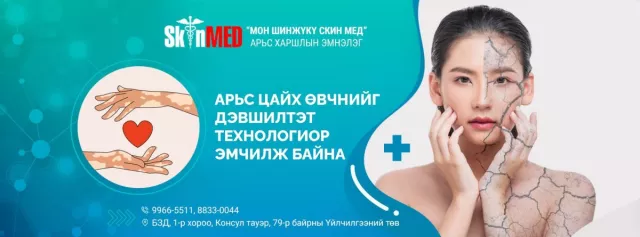 Арьс цайрах өвчний эмчилгээний төлбөрт 30-40 хувийн хөнгөлөлт зарлалаа