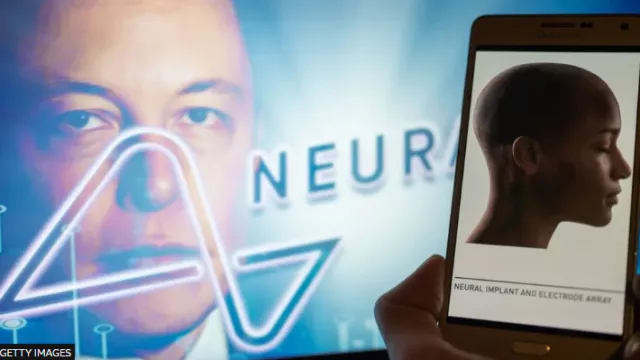 Элон Маск анхны Neuralink утасгүй тархины чипээ хүнд суулгаснаа зарлалаа