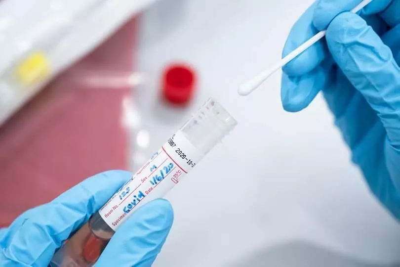 ХӨСҮТ: Амралтын өдрүүдэд PCR шинжилгээ авахгүй