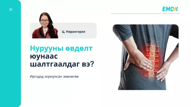 ЭМЧ: Нурууны өвдөлт юунаас шалтгаалдаг вэ?