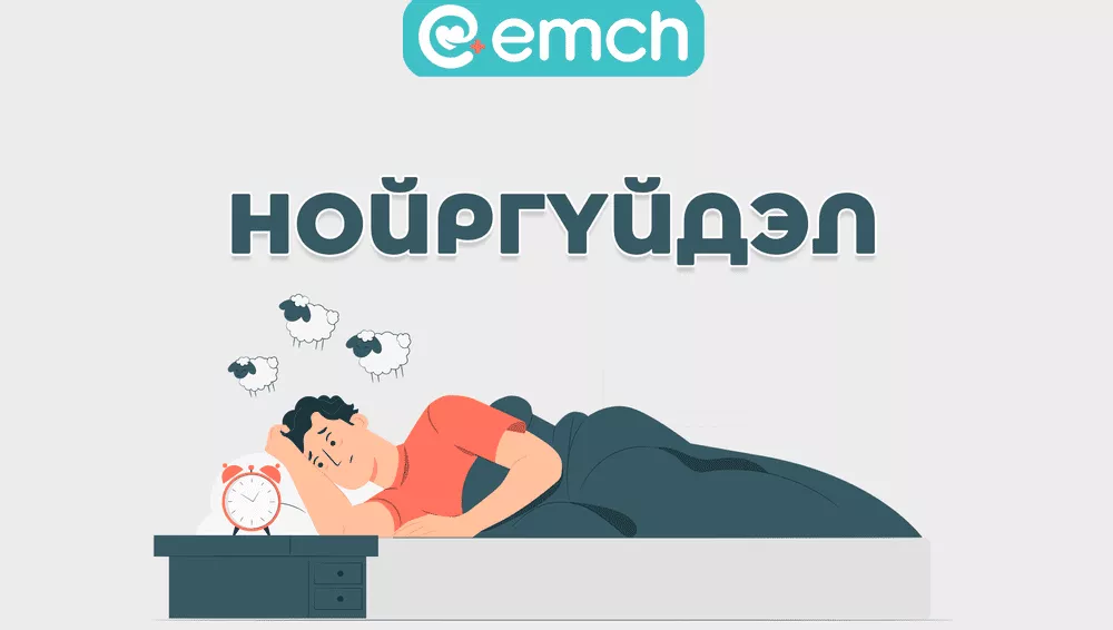 ЭМЧ: Нойр гэж юу вэ. Нойргүйдлийг хэрхэн давах вэ?