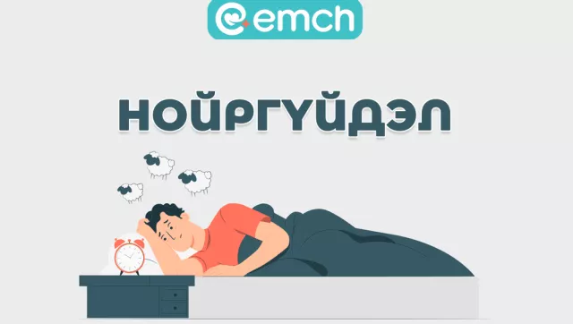 ЭМЧ: Нойр гэж юу вэ. Нойргүйдлийг хэрхэн давах вэ?
